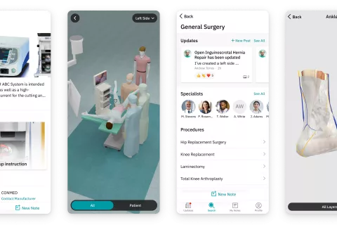 Screens of the Assist App showing the 3D OR setup, General Surgery overview, and an anatomy model.